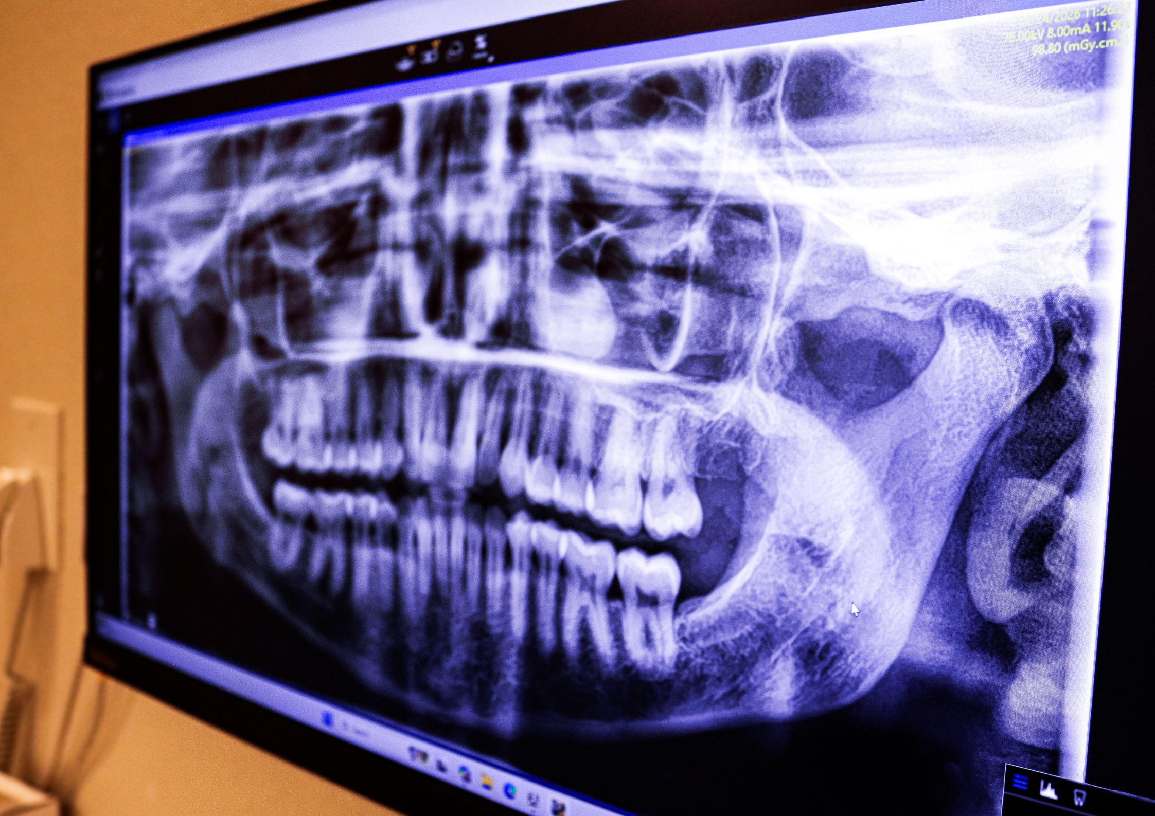 Sedation Dentistry McGregor